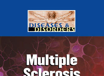 Multiple Sclerosis