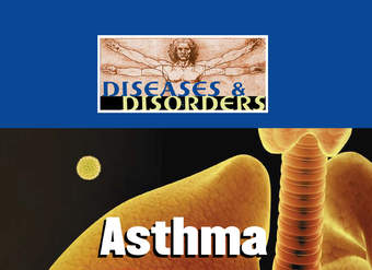 Asthma