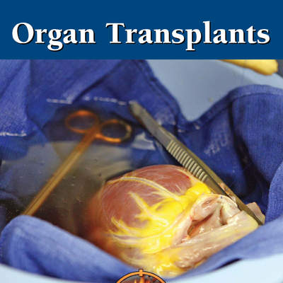 Organ Transplants