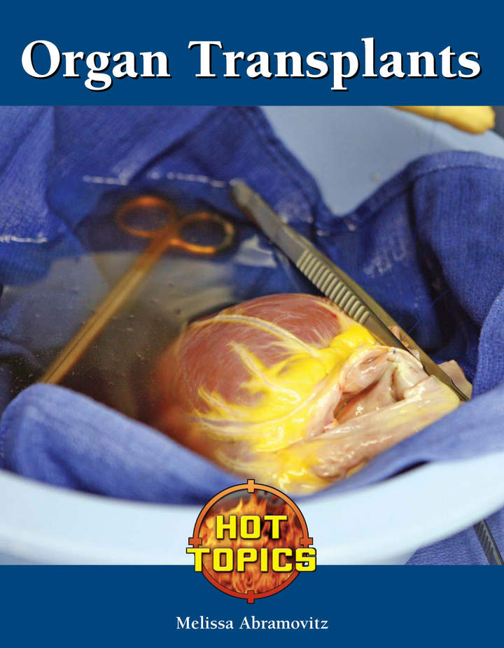 Organ Transplants