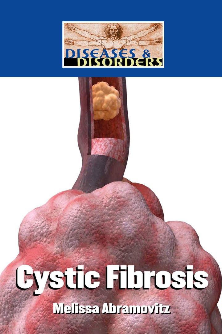 Cystic Fibrosis