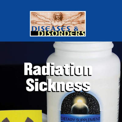 Radiation Sickness