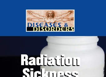 Radiation Sickness