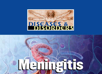 Meningitis