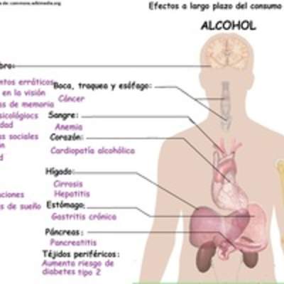 Imagen con información sobre los efectos a largo plazo del alcohol