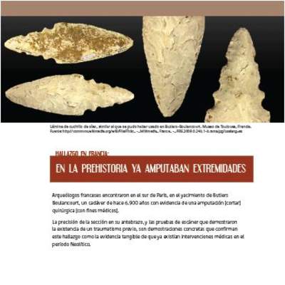 En la prehistoria ya amputaban extremidades