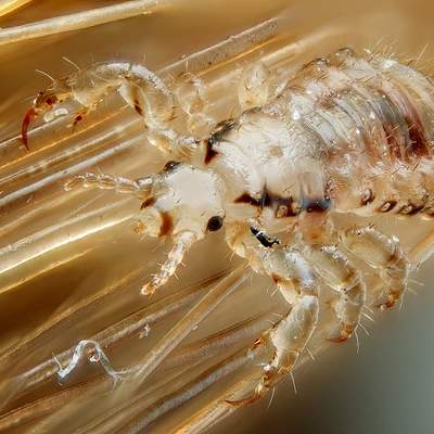 Parasitismo piojo en cabeza humana