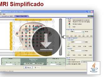 MRI Simplificado